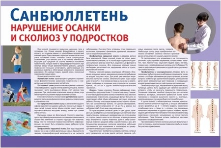 Стенд "Нарушение осанки и сколиоз у подростков" санбюллетень арт. МУ-0312
