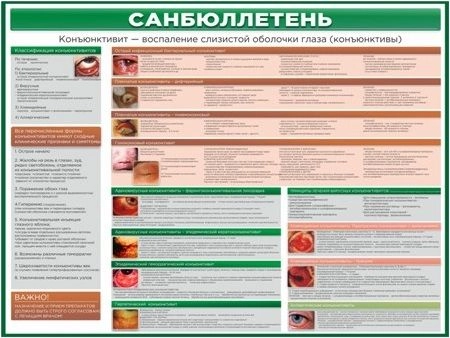 Стенд  "Конъюнктивит" санбюллетень арт. МУ-0341