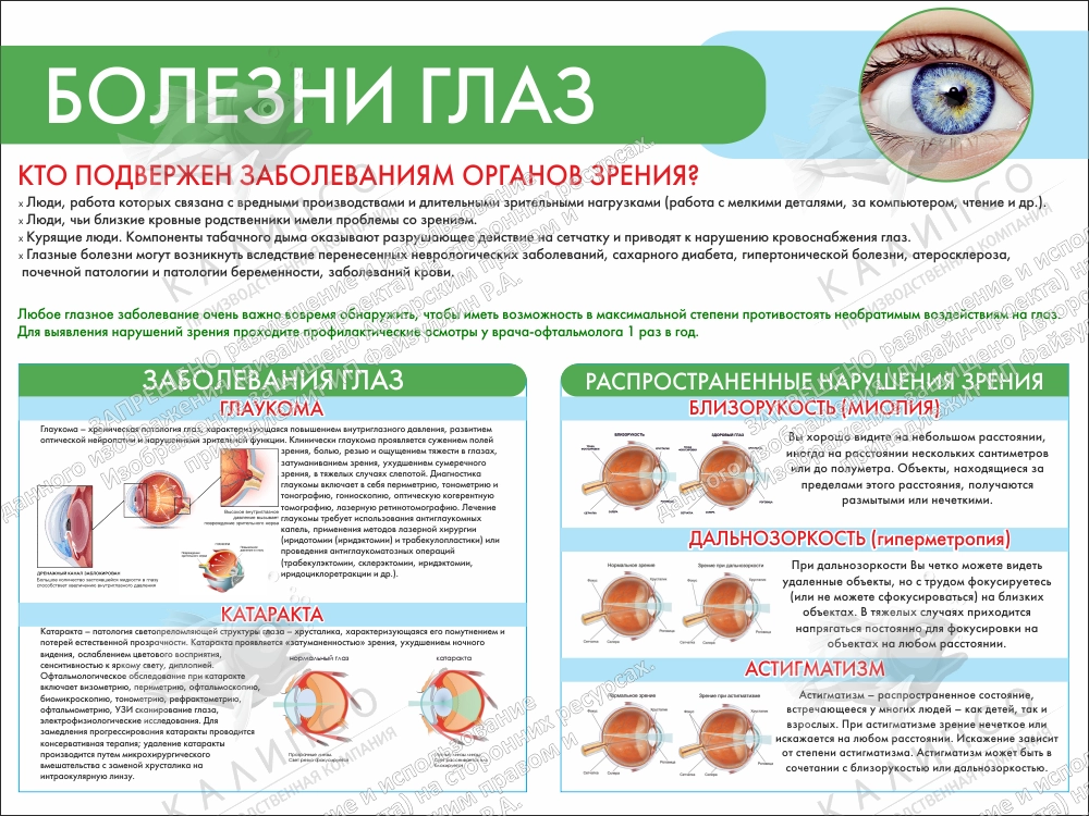 Стенд "Болезни глаз" санбюллетень арт. МУ-0414