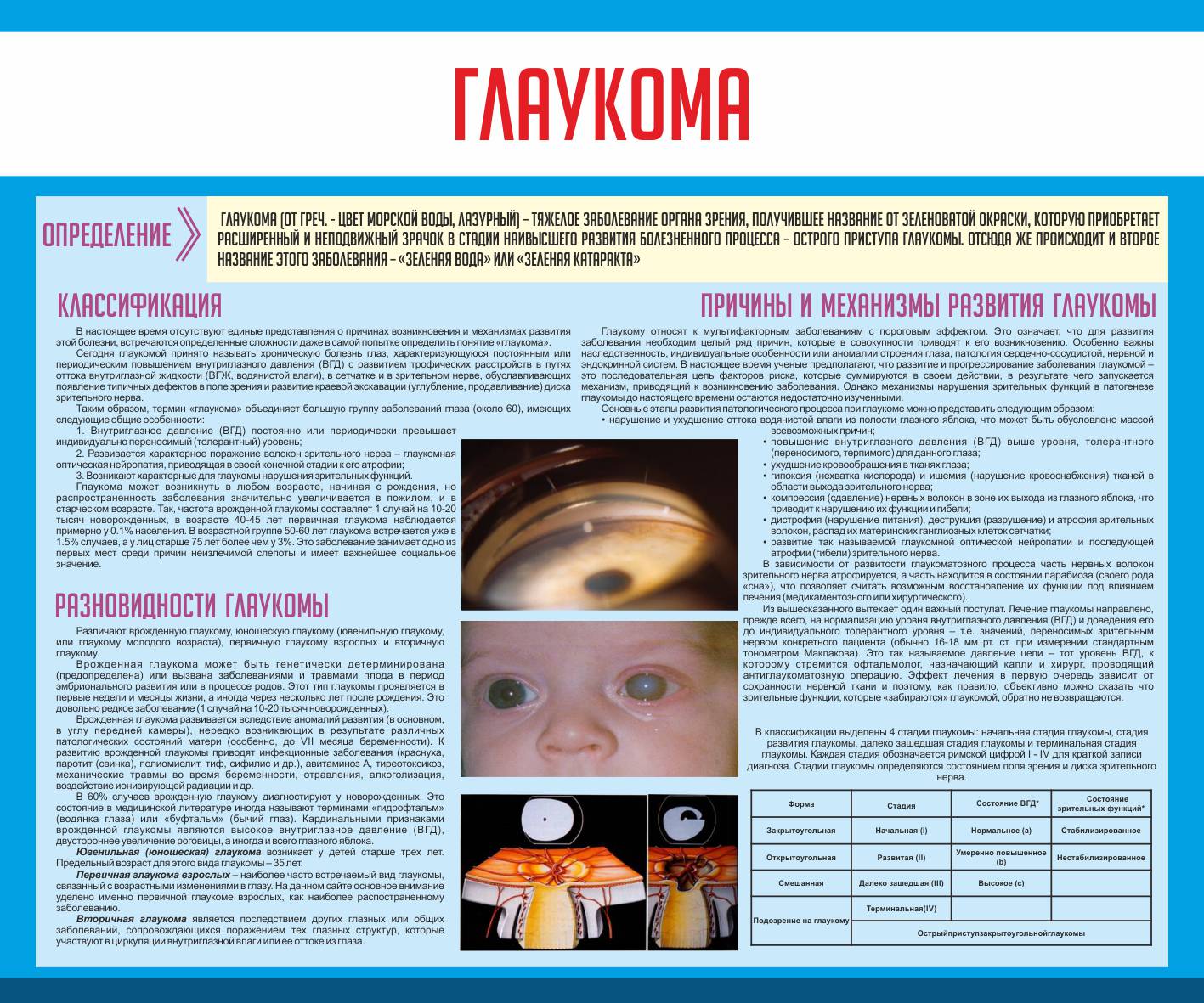 Лазерная комбинированная иридэктомия. Памятка по профилактике глаукомы. Лазерная иридэктомия послеоперационный период. Гипотензивная терапия глаукомы. Глаукома памятка.